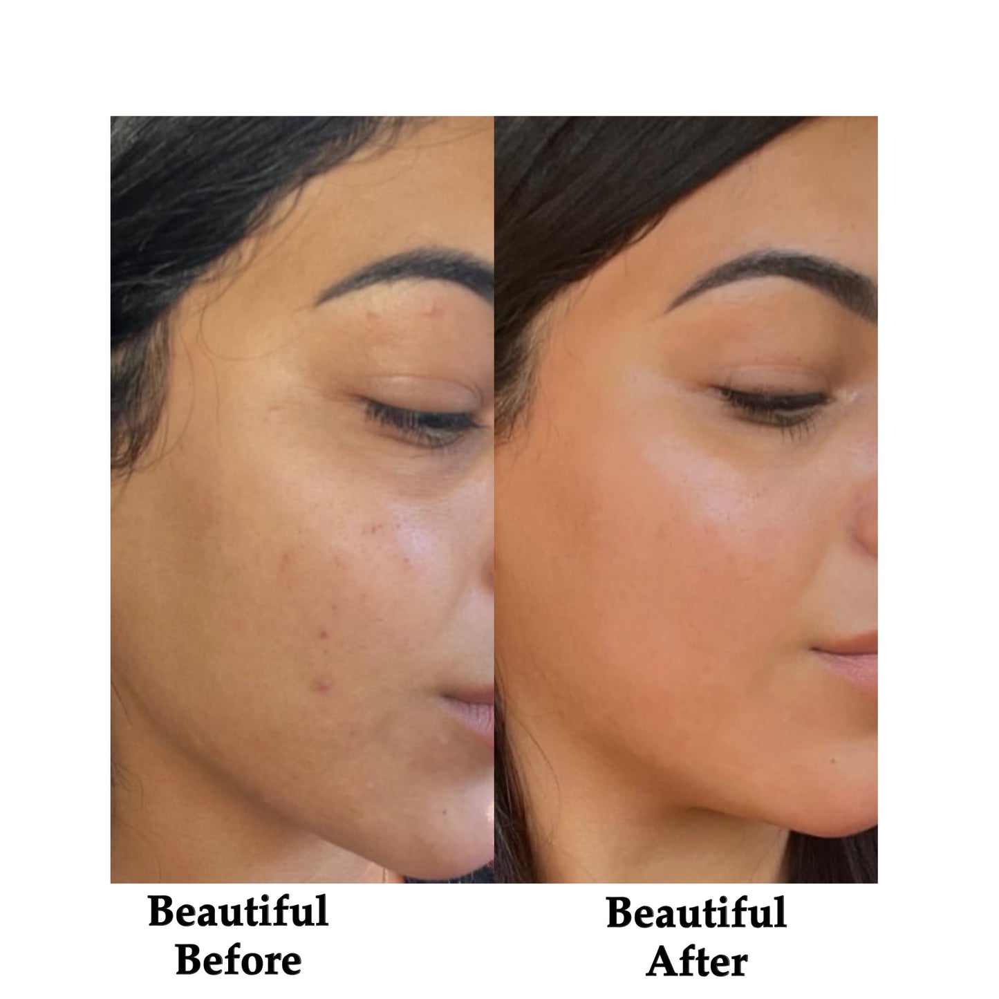 YOU GLOW SERUM
