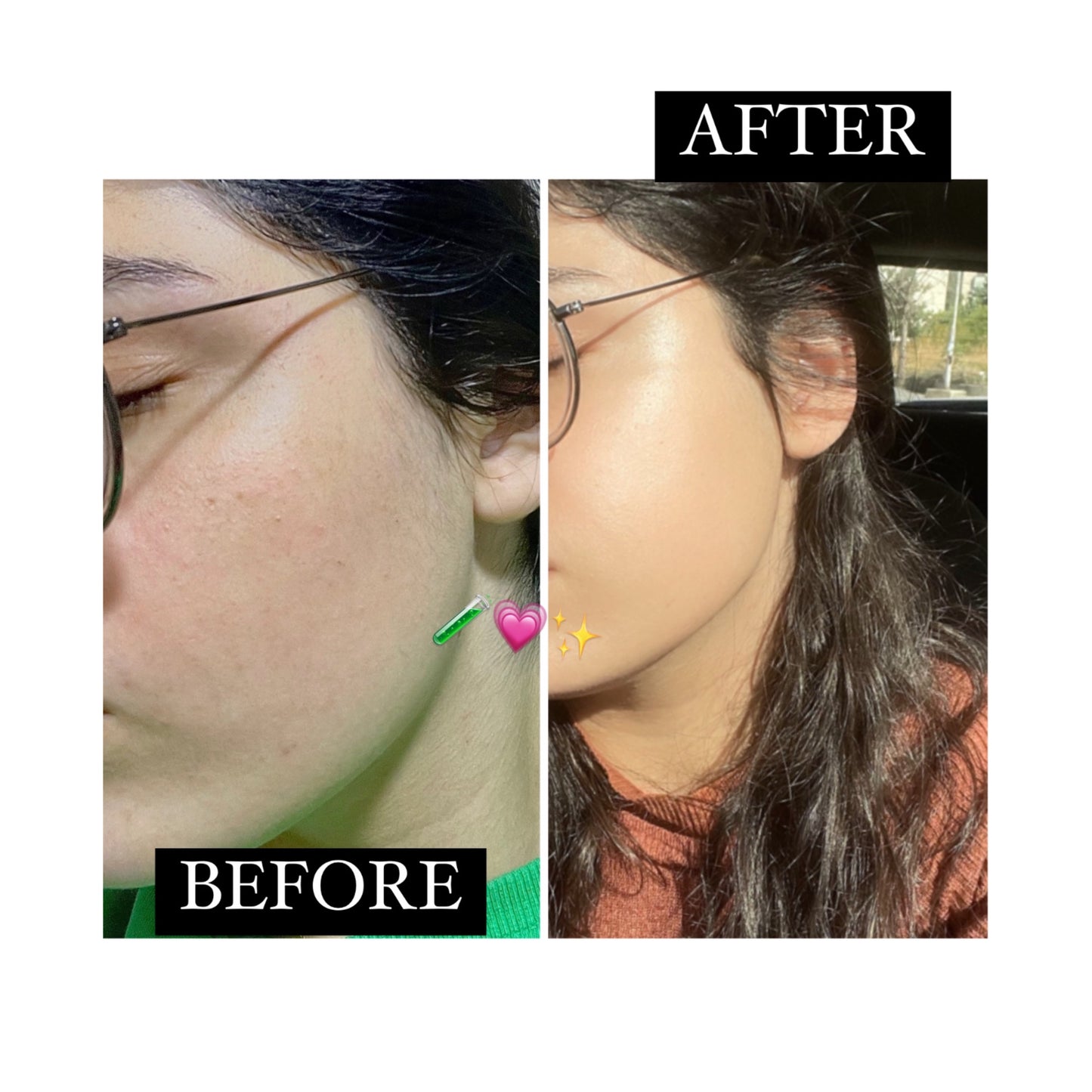 YOU GLOW SERUM