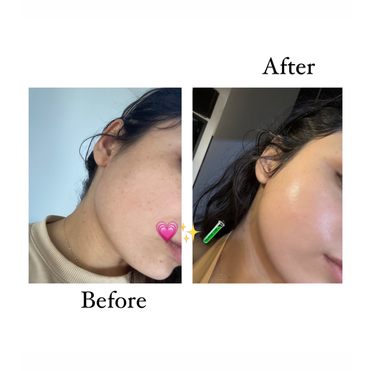 YOU GLOW SERUM